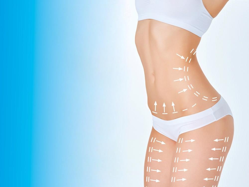 Liposuction 2