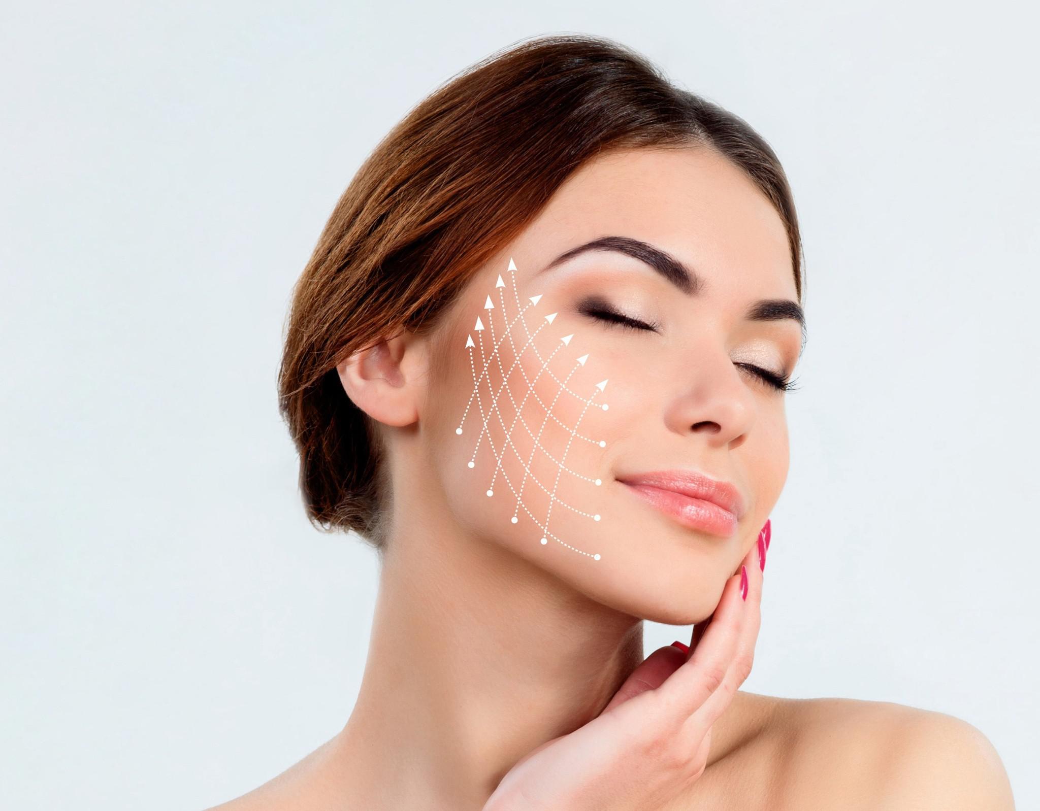 Thread lift: A Great Non-Surgical Alternative to the Facelift - Fuan Chan Plastic  Surgery